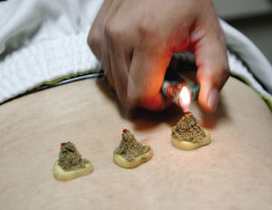 點擊將在新窗口查看全圖 艾灸養(yǎng)生術語