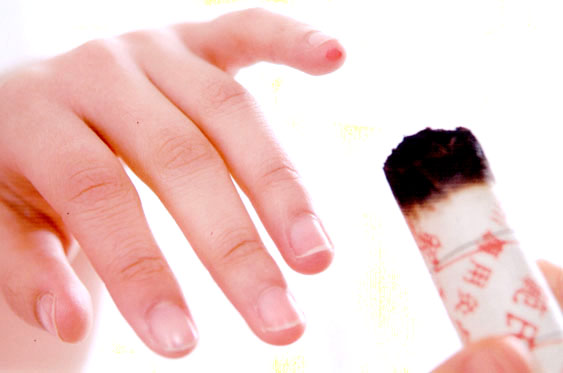 點擊將在新窗口查看全圖 艾灸療法之艾灰的作用