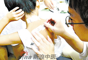 灸法的種類  你知道多少？